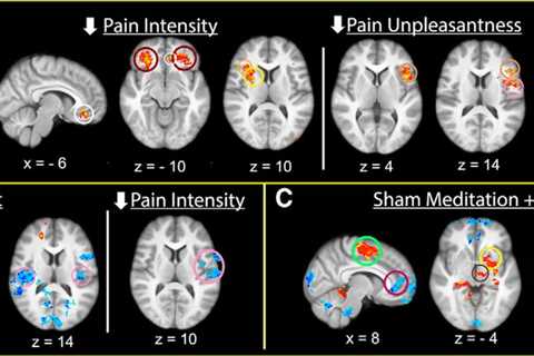 Meditation Versus Mindfulness