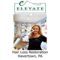 Hair Loss Restoration Havertown, PA - Elevate Medical Aesthetics