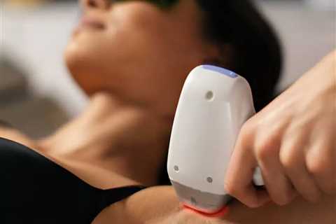 Laser Hair Removal Ardmore, PA